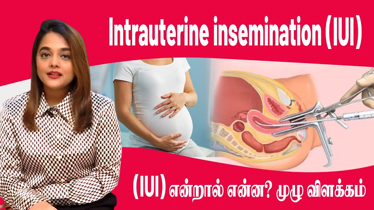 Intrauterine Insemination IUI YouTube