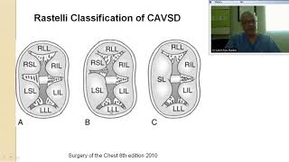 Av Canal Surgical Management By Dr Suresh Rao Old