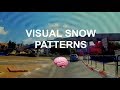 Updated visual snow simulation  what i see during daytime static tinnitus visual disturbance