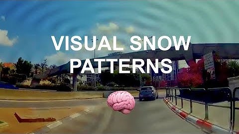 Updated: VISUAL SNOW Simulation - What I see during daytime, static, tinnitus, visual disturbance