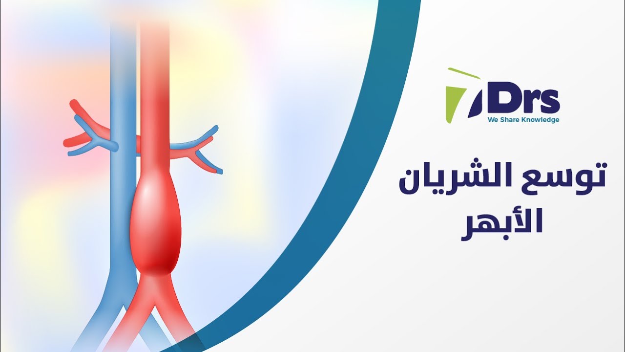 توسع الشريان الأبهر