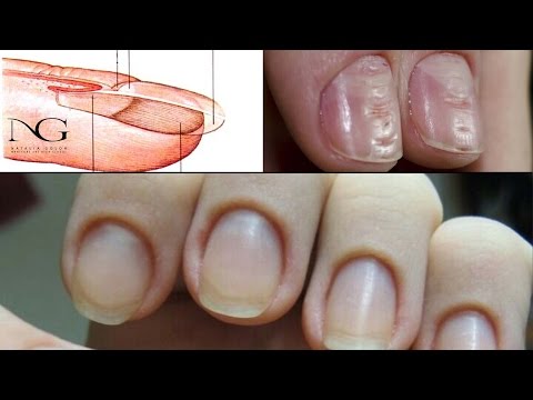 Строение ногтя и проблемы после маникюра. Ответы на вопросы. Periscope / The structure of the nail