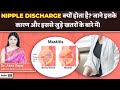 Nipple Discharge क्यों होता है? जाने इसके कारण और इससे जुड़े खतरों के बारे में! | Dr Akta | Tata 1mg