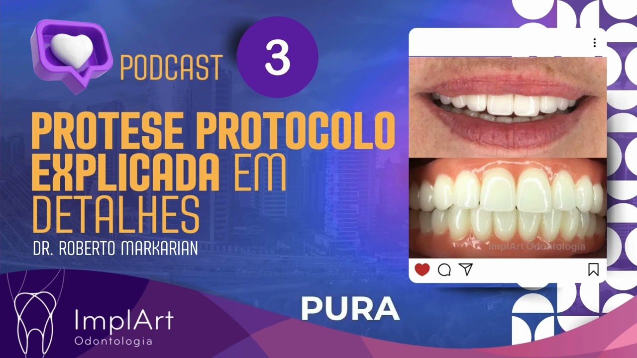 PRÓTESE PROTOCOLO conheça os detalhes deste tratamento com implante dentario PODCAST #implante
