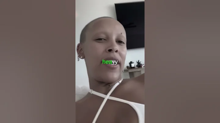 Doja Cat on her being bald 😳