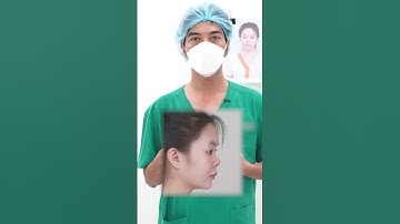 Short video|Thay đổi mũi thấp, ngắn cho khách hàng 2K đến từ Bến Tre