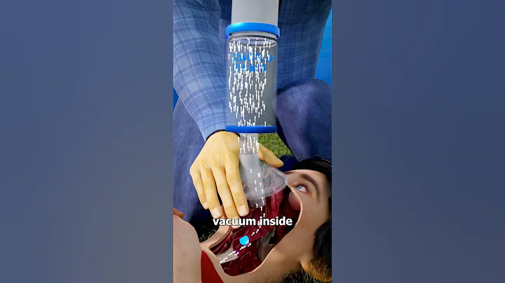 How A Dechoker Works 🫢