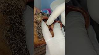 خلع الاسنان الملخلخه|| الأسنان السفليةdr_abdullah_sultan_dentist dentist orthodontics