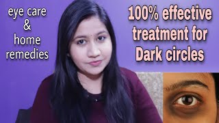 How to get rid of Dark circles | causes & treatment 100% effective home remedies |Tanushi and family
