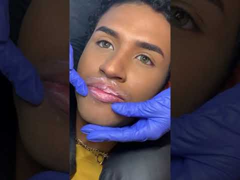 Vídeo: Como se livrar dos lábios rachados (com fotos)
