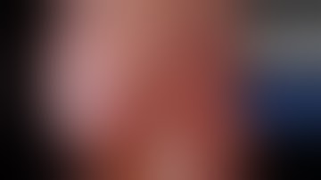 uniportal VATS RUL + LND (advanced instrumentation)