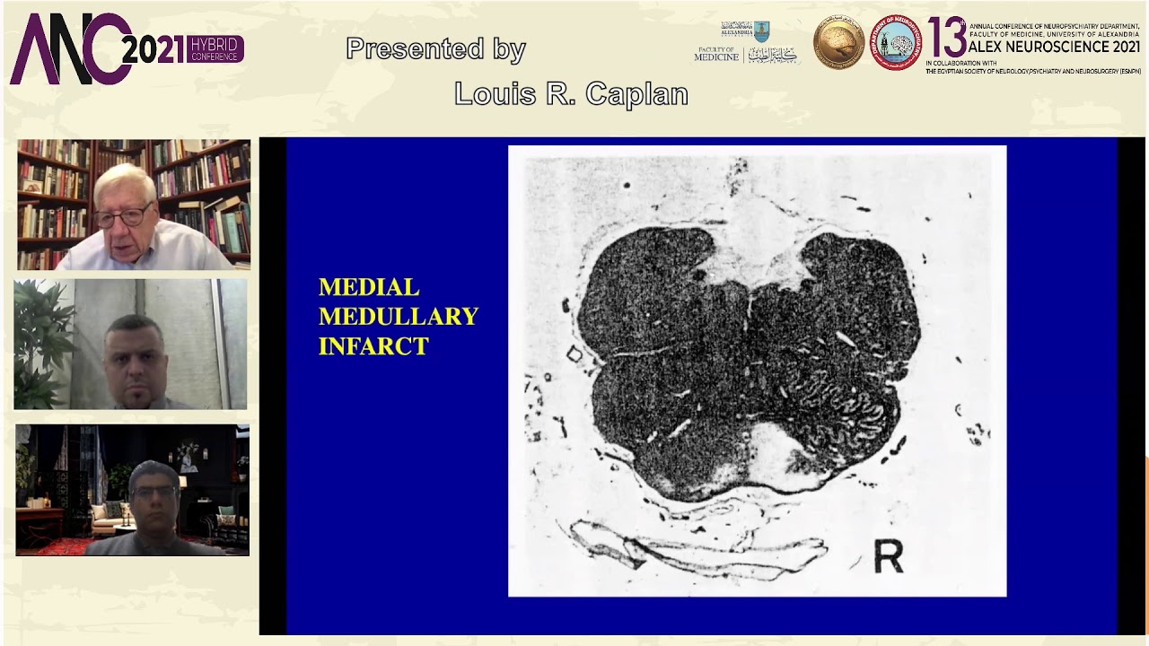 02 Louis R Caplan The importance of clinical brain imaging patterns in
