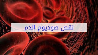 نقص صوديوم الدم