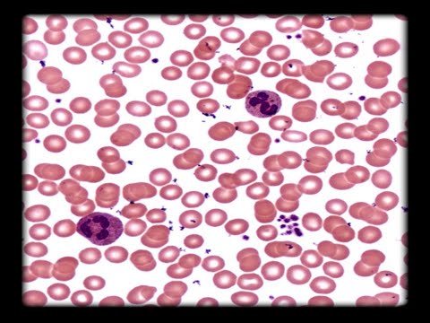 Capsule 14B-Les groupes sanguins