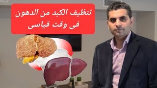 كيف تنظف الكبد من الدهون فى وقت قياسى