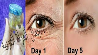 تخلصى من تجاعيد العين وتجاعيد تحت العين  فى 5 ايام لبشرة اصغر ب 10 سنوات بدون تجاعيد