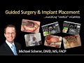 Avoiding Rookie Problems During Guided Surgery and Implant Placement