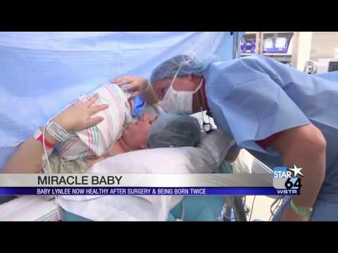 Miracle baby born twice