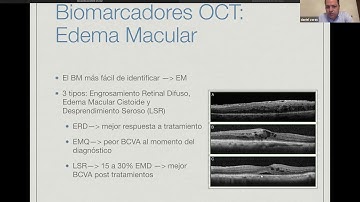 Biomarcadores en OCT y OCTA para Edema Macular Diabético