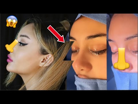 I GET A NOSE JOB.. to look like Ariana Grande?? *embarrassing footage*