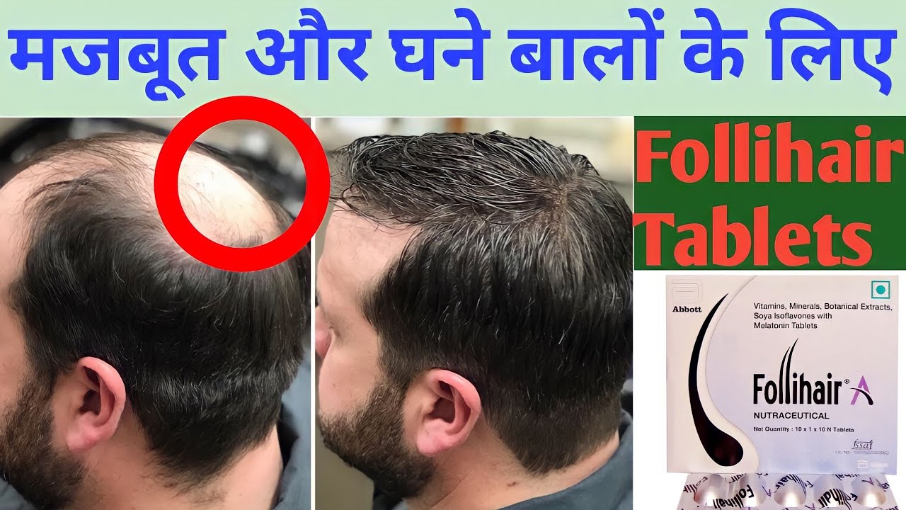 Follihair Tablet Review Best Medicine For Hair Growth YouTube follihair-tablet-review-best-medicine-for-hair-growth-youtube