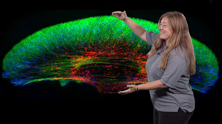 Julie Theriot (Stanford, HHMI) 2: Mechanics and Dy...
