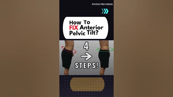 Here's how you fix lumbar Hyperlordosis or Anterior pelvic tilt #shortsfeed #shorts