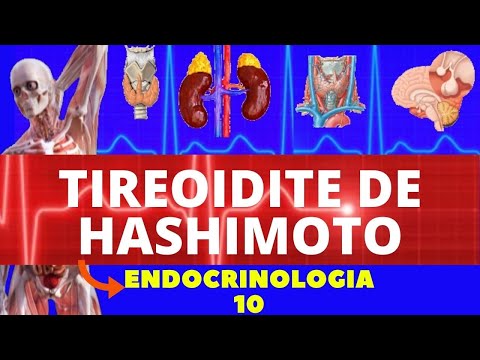 Vídeo: A Tireoidite De Hashimoto Prejudica O Implante De Embriões, Comprometendo A Morfologia Endometrial E Os Marcadores De Receptividade Em Camundongos Eutireóideos