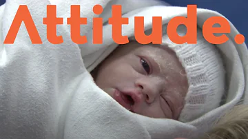 Is VSD related to Down syndrome?