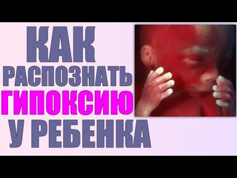 КОГДА РЕБЕНКУ НЕ ХВАТАЕТ КИСЛОРОДА ВО ВРЕМЯ БЕРЕМЕННОСТИ | Причины и лечение гипоксии плода