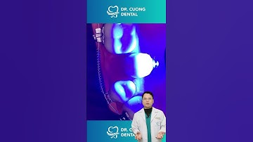 Kéo răng trong niềng răng |Dr Cường Official