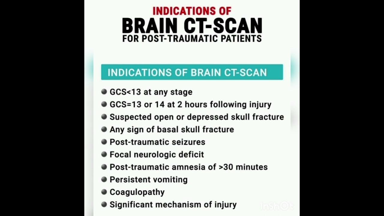 🌀 Brain CT scan indication 🌀 YouTube