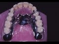 Prótesis dentales T.18