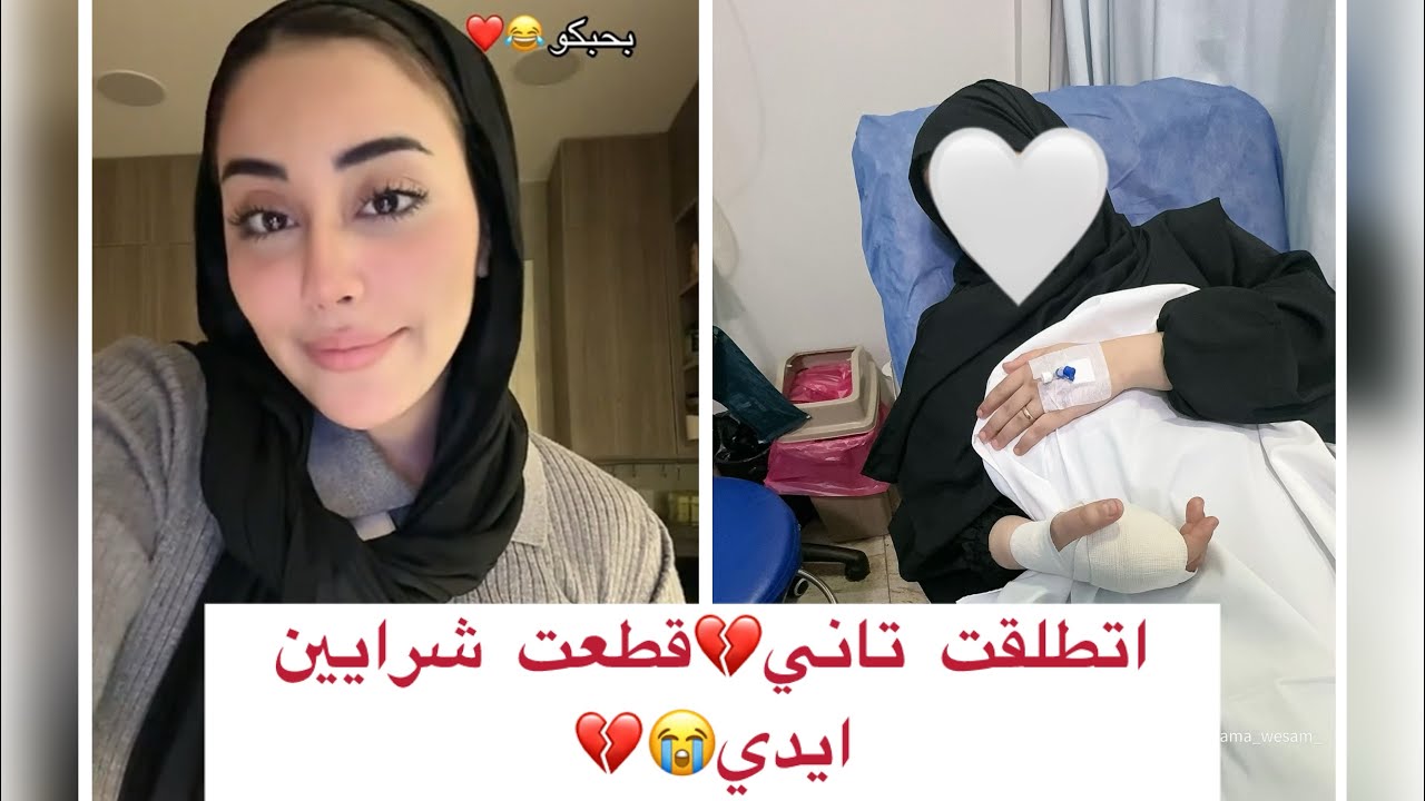 Она снова развелась 💔 Развод Самасимо и Мидо, и что с ней случилось? Мидо ударил ее и порезал ей ...