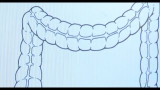 Colon Health Tips by LivingHealthyChicago 1,472 views 2 years ago 2 minutes, 29 seconds