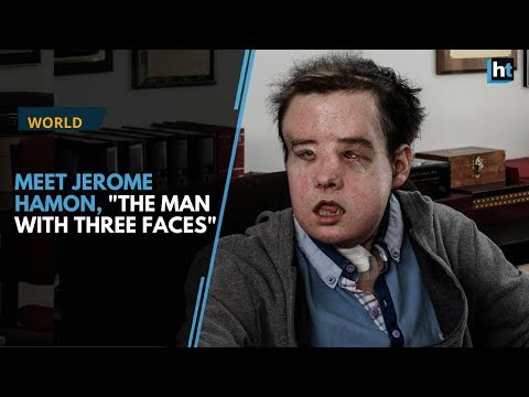 Meet Jerome Hamon, "the man with three faces"