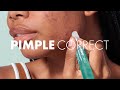 Heros newest product pimple correct 