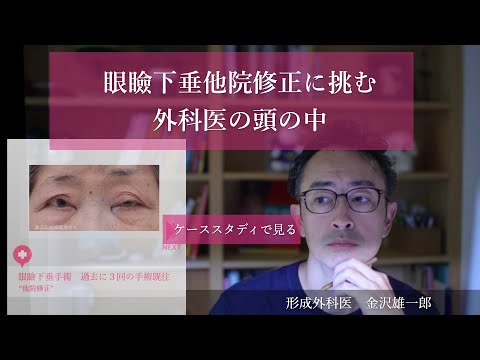 眼瞼下垂他院修正手術に挑む外科医の頭の中のほんの少しだけ
