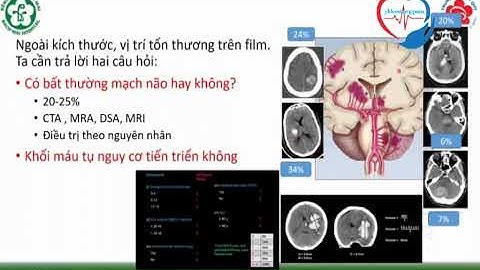 Điều trị đột quỵ chảy máu não cấp