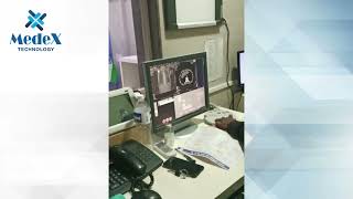 Siemens Sensation 64 Slice CT Scan Machine