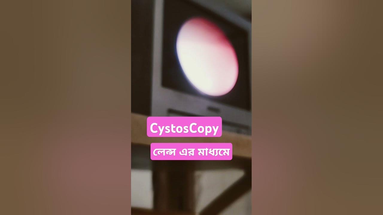 Urology #work #cystoscopy #doctor #hindisong #bollywood #song #bollywoodsongs #love