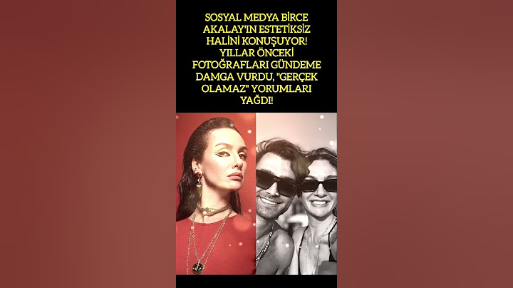 BİRCE AKALAY'IN ESTETİKSİZ HALİ SOSYAL MEDYADA GÜNDEM OLDU!