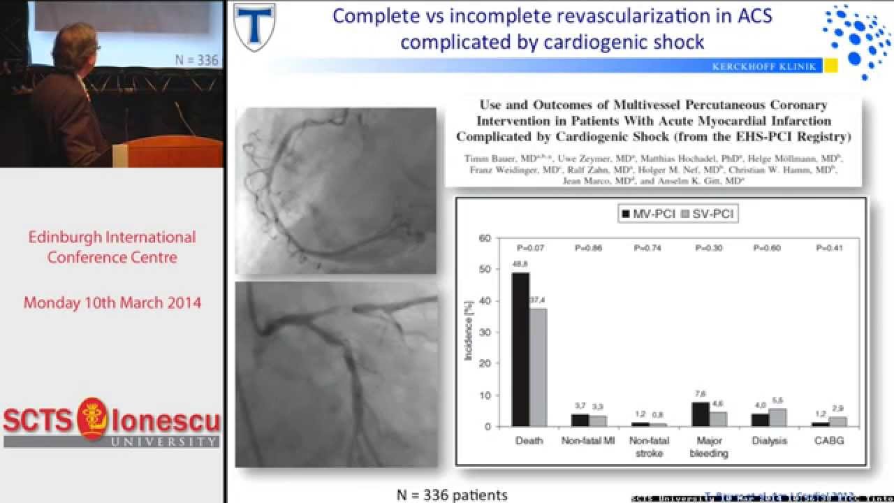 Complete revascularisation - evidence in PCI