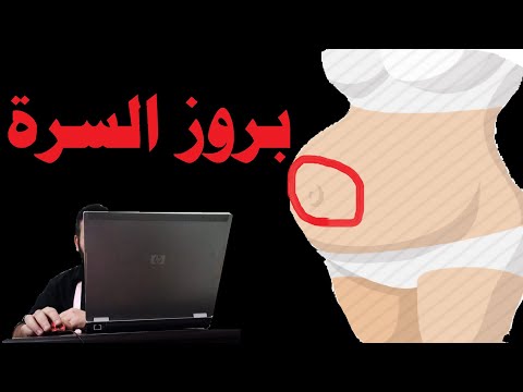 فيديو: متى تخرج السرة في الحمل؟