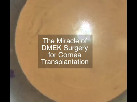 The miracle of DMEK Surgery.  Shannon Wong, MD. 4-1-2019