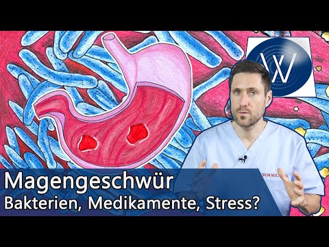 Magengeschwür: Wie gefährlich ist es & was kann ich dagegen tun? Ursachen & Therapie vom Magenulkus