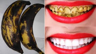 ستجعل هذه الطريقة أسنانك المصبوغة باللون الأصفر بيضاء ولامعة في 3 دقائق. علاج تبييض الاسنان