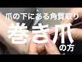 足の巻き爪ケアしたらたくさんの角質や汚れが爪下からでてきた!フォルムジェルで巻き爪ケア