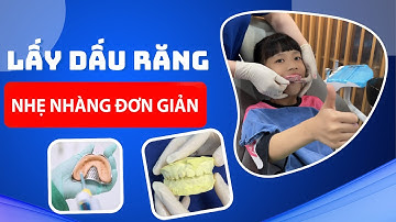 Lấy Dấu Răng - Bước Quan Trọng Trong Chỉnh Nha | Nam Bùi Vinalign