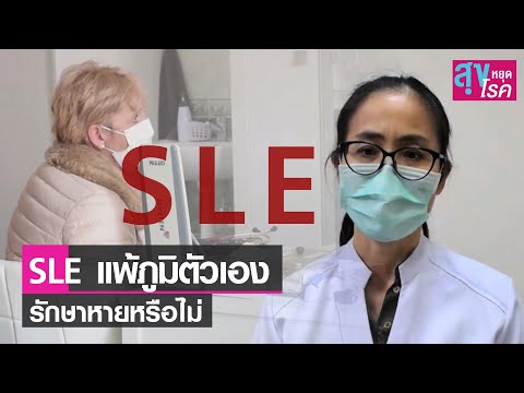 โรคแพ้ภูมิตัวเอง SLE รักษาหายหรือไม่ l สุขหยุดโรค l 06 03 65